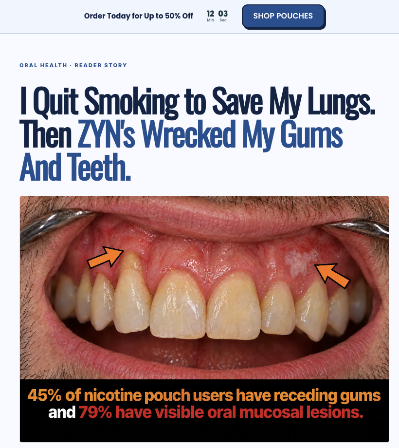 I Quit Smoking to Save My Lungs. Then ZYN's Wrecked My Gums And Teeth.